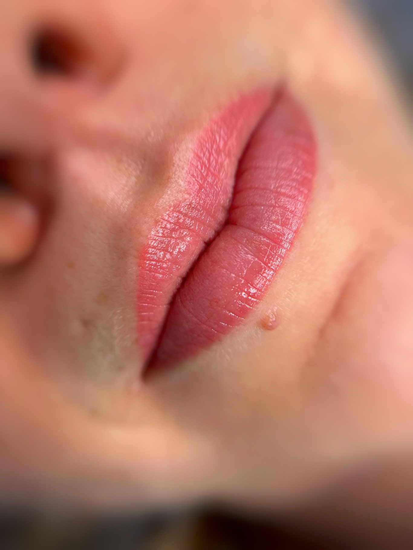Verheilte Lippen nach der 1. Behandlung